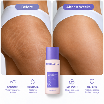 Nexaluma Tighten & Smooth Belly Cream