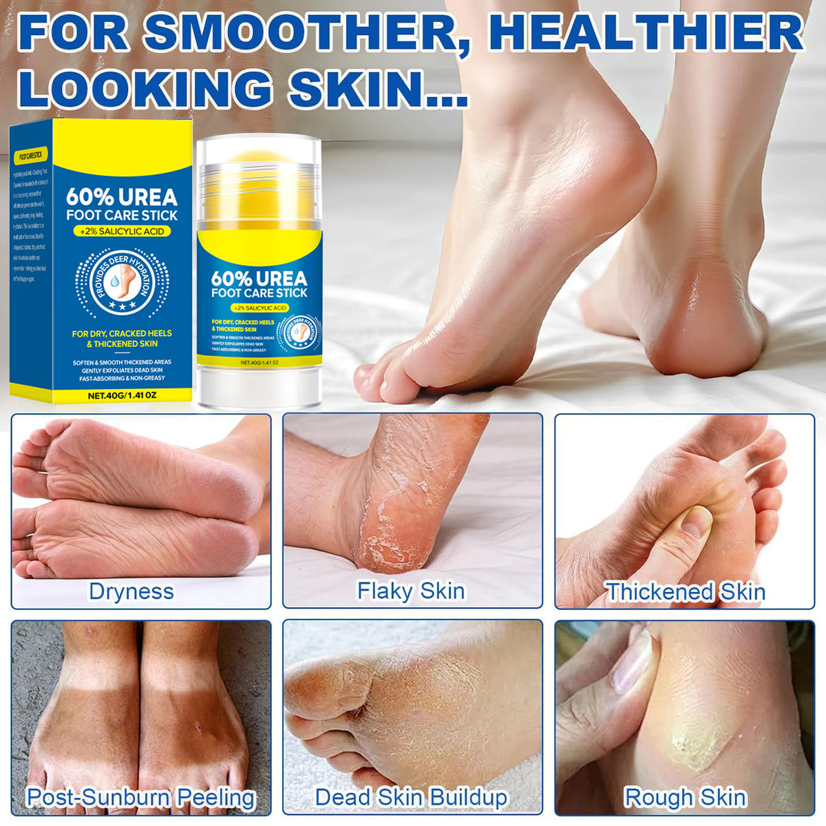 60% Urea Foot Cream