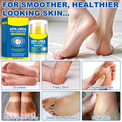 60% Urea Foot Cream